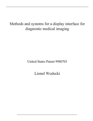 Methods and systems for a display interface for diagnostic medical imaging: United States Patent