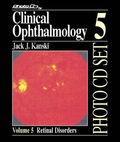 Clinical Ophthalmology