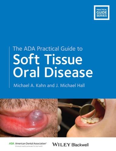 The ADA Practical Guide to Soft Tissue Oral Disease: (ADA Practical Guide)
