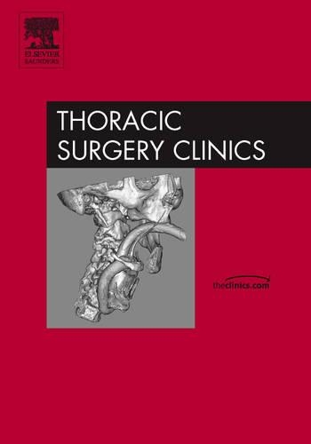 Preoperative Preparation of Patients for Thoracic Surgery