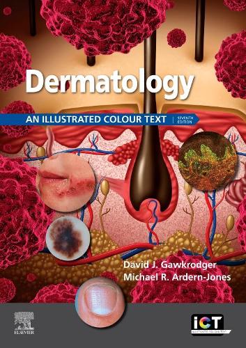 Dermatology E-Book: Dermatology E-Book(Illustrated Colour Text)
