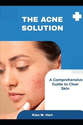 The Acne Solution