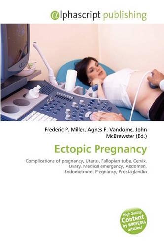 Ectopic Pregnancy: (English)