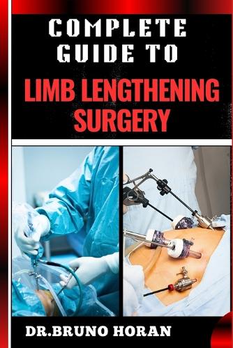 Complete Guide to Limb Lengthening Surgery