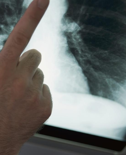 Science Theme School Composition Book Radiologist Reading Xray: Science Class School Composition Books Notebooks (Notebook, Diary, Blank Book)