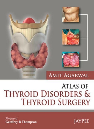 Atlas of Thyroid Disorders and Thyroid Surgery: (English)
