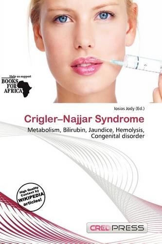 Crigler-Najjar Syndrome
