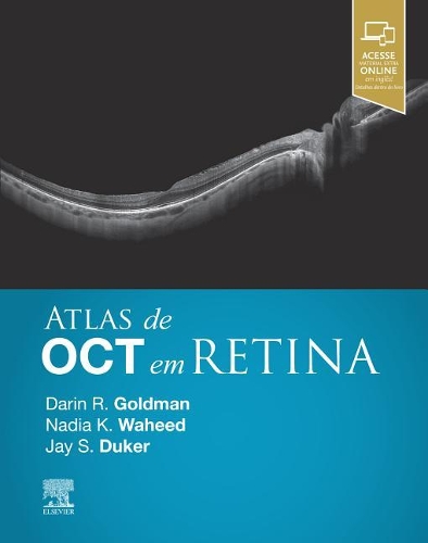 Atlas de Oct Em Retina