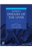 Schiff's Diseases of the Liver