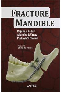 Fracture Mandible