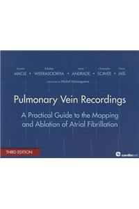 Pulmonary Vein Recordings