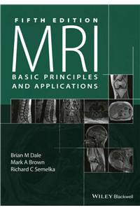 MRI: Basic Principles and Applications