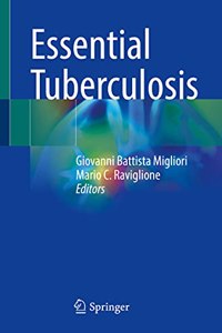 Essential Tuberculosis