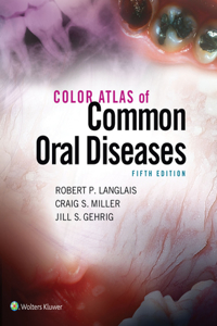 Color Atlas of Common Oral Diseases