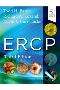 Ercp