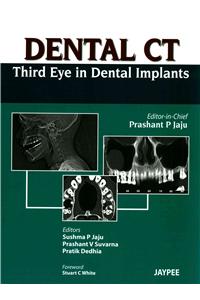 Dental CT Third Eye in Dental Implants: Third Eye in Dental Implants