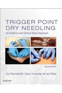 Trigger Point Dry Needling