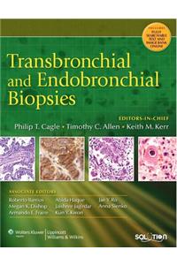 Transbronchial and Endobronchial Biopsies