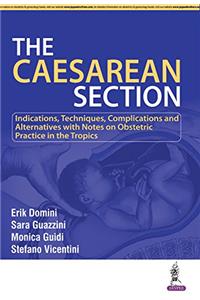 Caesarean Section