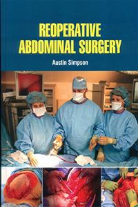 REOPERATIVE ABDOMINAL SURGERY (HB 2021)