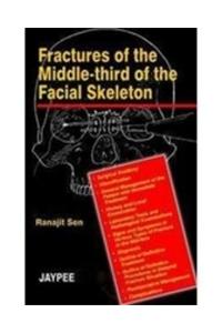 Fractures of the Middle-third of the Facial Skelton