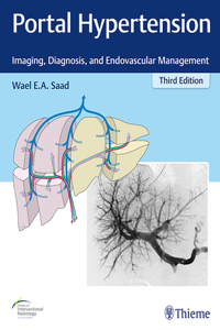 Portal Hypertension: Imaging, Diagnosis, and Endovascular Management