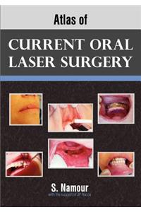 Atlas of Current Oral Laser Surgery