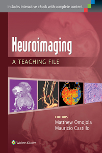 Neuroimaging: A Teaching File