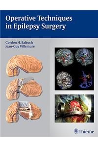 Operative Techniques in Epilepsy Surgery