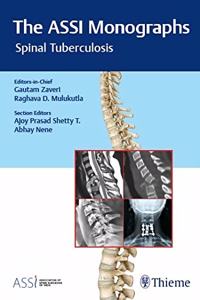 The ASSI Monographs-Spinal Tuberculosis