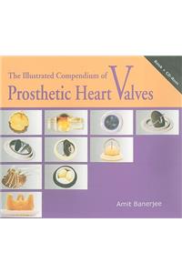 The Illustrated Compendium of Prosthetic Heart Valves