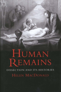 Human Remains