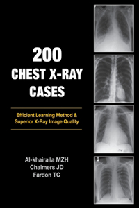 200 Chest X-Ray Cases