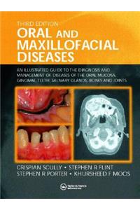 Oral and Maxillofacial Diseases: An Illustrated Guide to Diagnosis and Management of Diseases of the Oral Mucosa, Gingivae, Teeth, Salivary Glands, Bones and Joints