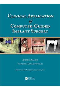 Clinical Application of Computer-Guided Implant Surgery