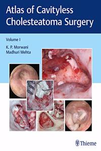 Atlas of Cavityless Cholesteatoma Surgery, Vol 1