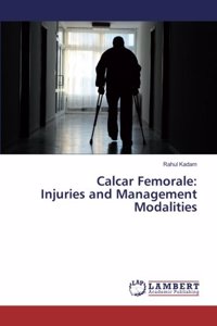 Calcar Femorale: Injuries and Management Modalities