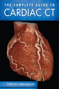 Complete Guide to Cardiac CT (Pb)