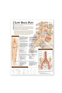 Understanding Low Back Pain Anatomical Chart