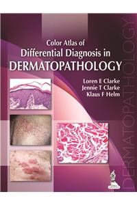 Color Atlas of Differential Diagnosis in Dermatopathology