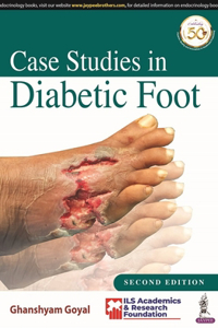 Case Studies in Diabetic Foot