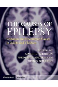 The Causes of Epilepsy: Common and Uncommon Causes in Adults and Children: Common and Uncommon Causes in Adults and Children
