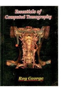 Essentials of Computed Tomography