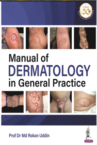 Manual of Dermatology in General Practice