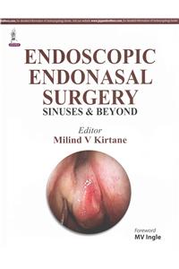 Endoscopic Endonasal Surgery