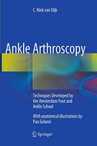 Ankle Arthroscopy