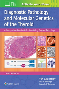 Diagnostic Pathology and Molecular Genetics of the Thyroid