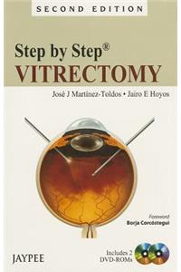 Step by Step: Vitrectomy: Vitrectomy