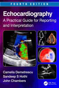 Echocardiography