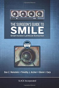 Surgeon's Guide to SMILE